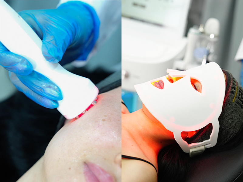 Radyofrekans ve LED Maske